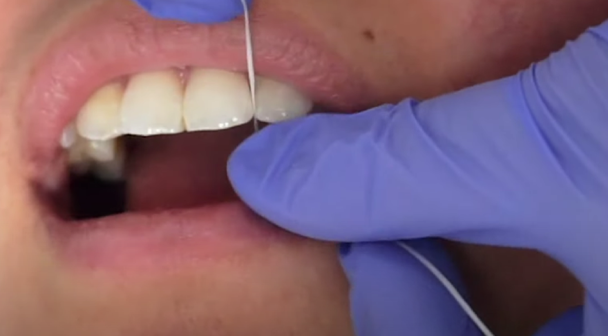 Dentist Procedure