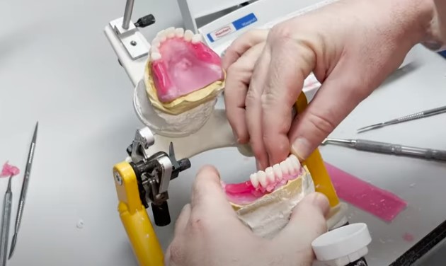 Aligning teeth on gums