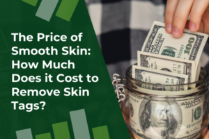 The Price of Smooth Skin